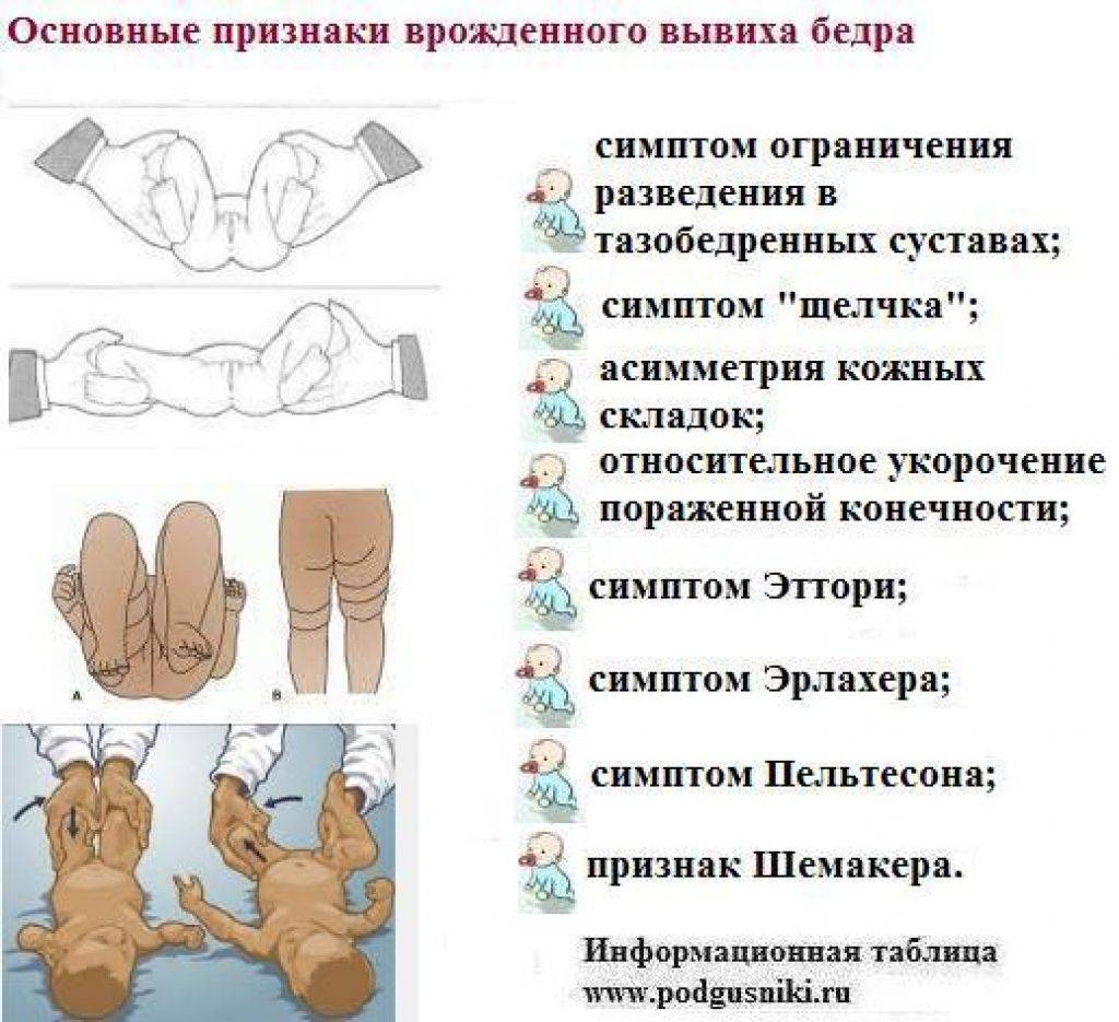 Что делать, если у младенца не симметричны складки на ножках — блог медицинского центра он клиник